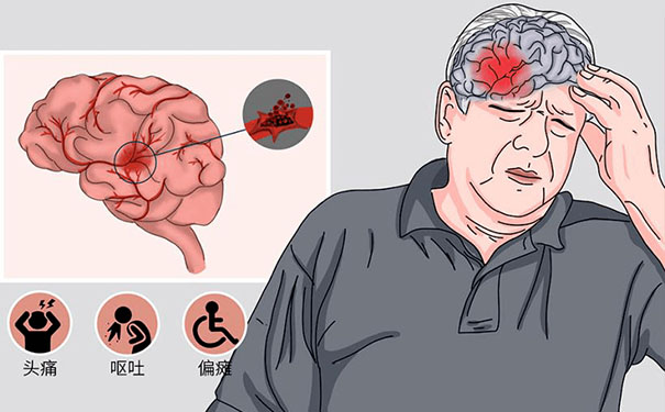 大眾康養網為腦梗病人通過快速篩選康復醫院服務，抓住腦梗康復黃金期